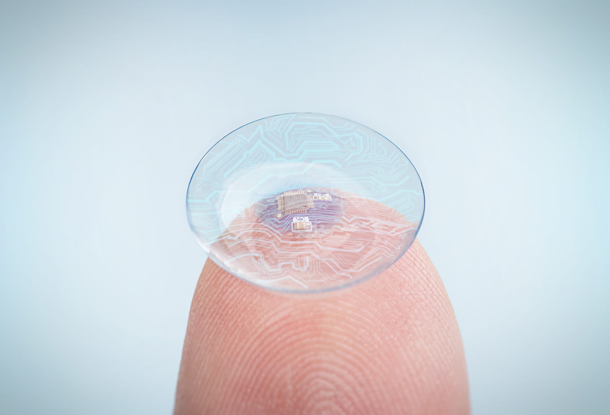 The Rise of Smart Contact Lenses in Eye Health - Optometry Innovations